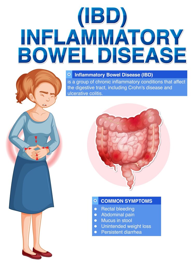 CBD for Digestive Issues: IBS, Crohn's, and More