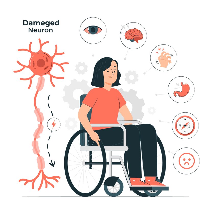 Exploring the Potential: Research on CBD for Multiple Sclerosis (MS)