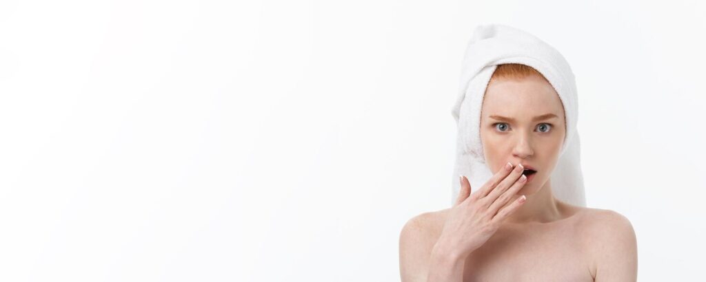My Experience Using CBD for Acne Treatment